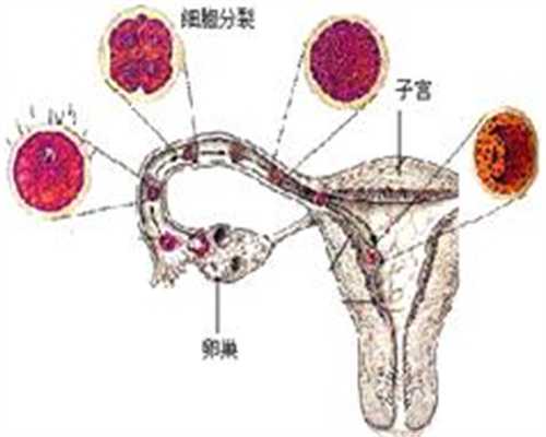 徐图图代孕：女性没代孕检查只要十分钟