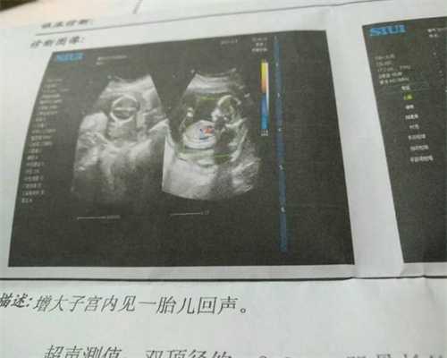 杭州有代孕吗：奚梦瑶代孕五个月走红毯，代孕