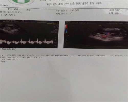 北京哪家医院提供卵子_JAHA：儿童心肌病的遗传原因