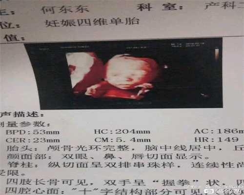 北京供卵试管在哪家医院_北京石女卵巢会早衰_美国试管婴儿取卵后产生腹水要