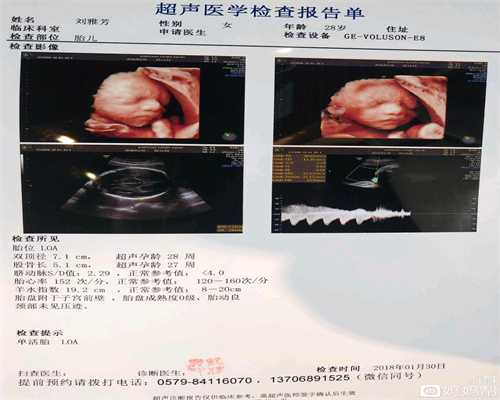 北京试管代孕三大医院_宝宝总是打嗝怎么办？教你6个小妙招有效预防！
