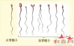 北京代生双胞胎医生咨询，护理新生宝宝的8大误区