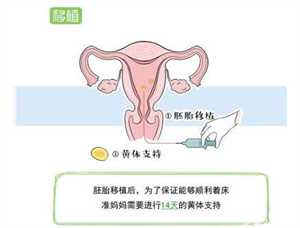 北京供卵代生价格~北京地下供卵~北京地下供卵机构靠谱吗，做试管婴儿在月经